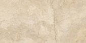 Portofino 24x48F Beige | Glens Falls Tile & Supplies